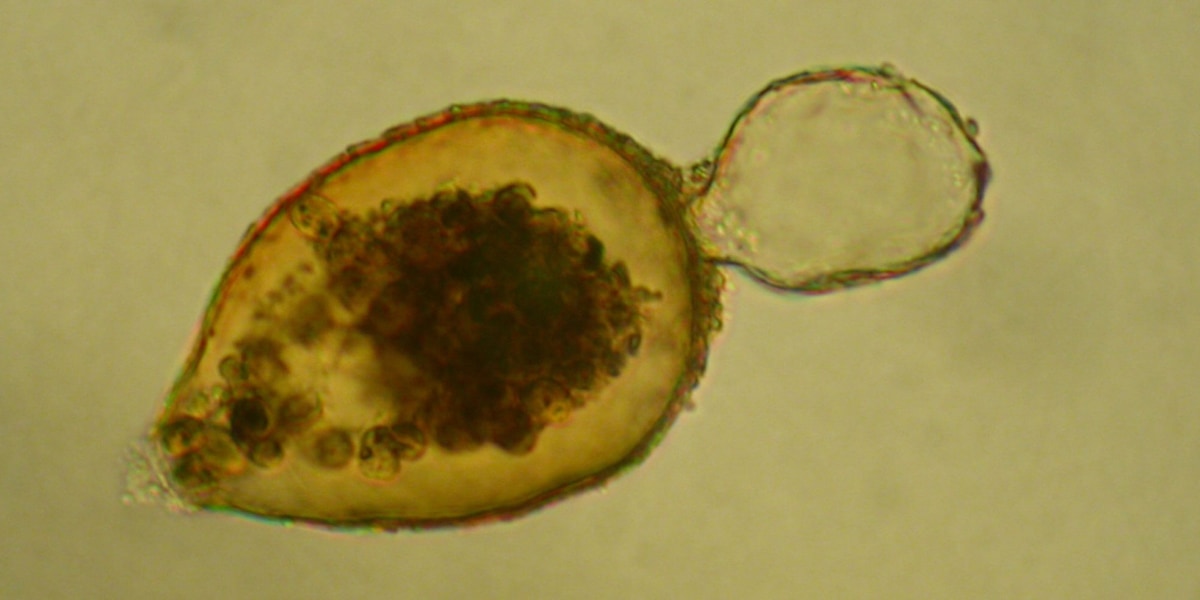 磁気を帯びている有孔虫「レジゲラ・ビロクラリス（Resigella bilocularis）」