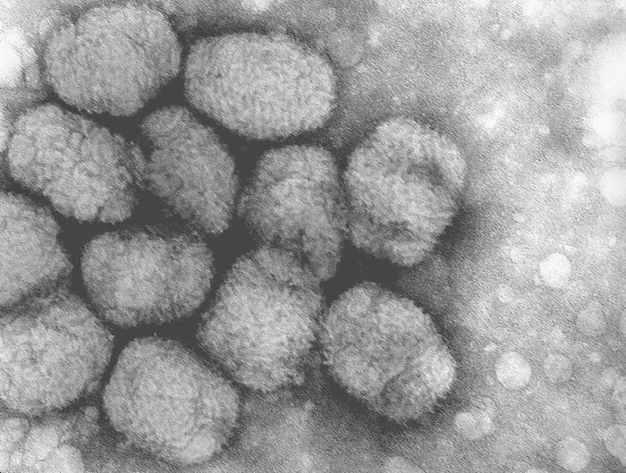天然痘ウイルス