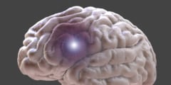 脳治療に役立つ磁気制御マイクロデバイス