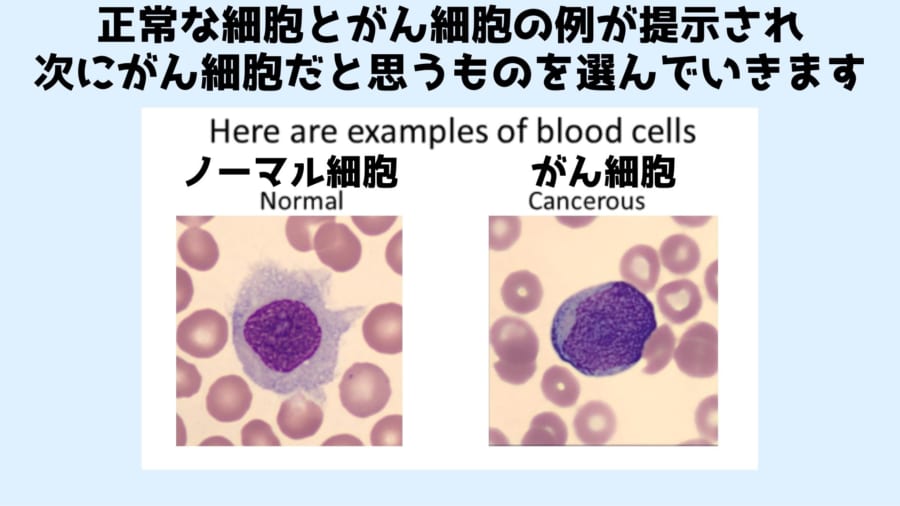 1番目は参考画像をもとに、正常な細胞とがん細胞をみわけるテストです