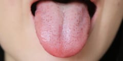 女性の舌