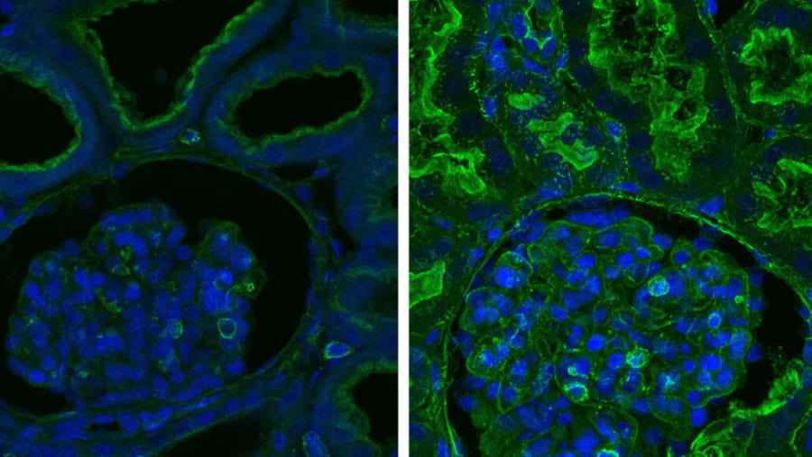 左：死んだブタの細胞、右：OrganExで活性化した細胞（緑色の部分は、活動状態にある細胞が使うタンパク質・アクチンを示す）