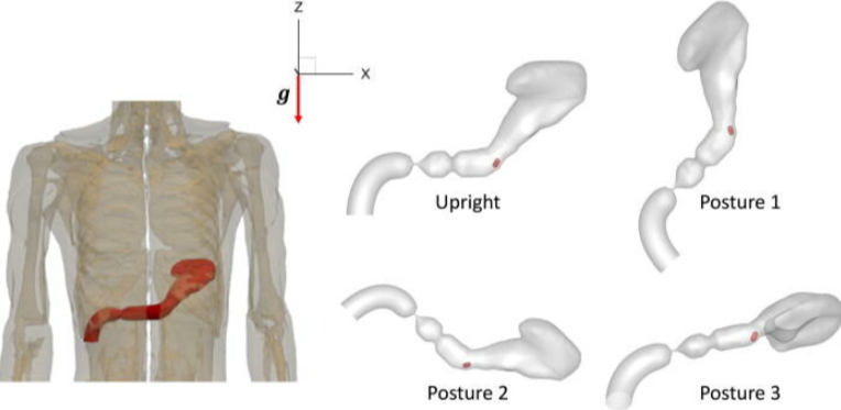 4つの姿勢における胃の状態。直立（Upright）、右傾（Posture1）、左傾（Posture2）、後傾（Posture3）。右傾時には胃が重力の向きに対して並行になり、薬が奥に落ちやすい