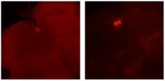 働きアリ（左）とガマゲイト（右）の脳内でのインスリン分泌（赤い部分）、ガマゲイトの方が分泌レベルが高い