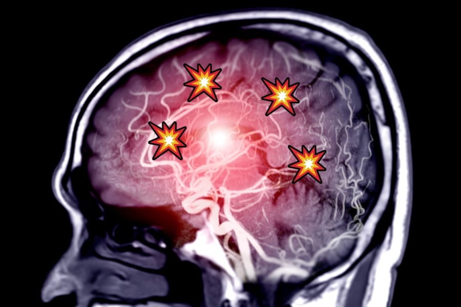 「具合の悪さ」を起こす脳回路を発見！
