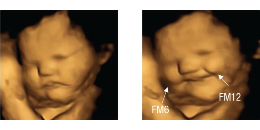 胎児はお腹の中で母親が食べたものの 味 に反応していた 表情の観察に初成功 ナゾロジー