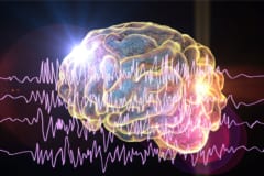 脳波は脳活動に伴う電気活動を記録したもの