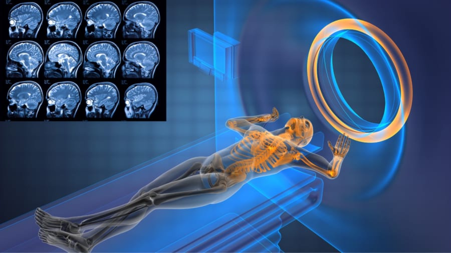 MRIは脳活動を測定することができる