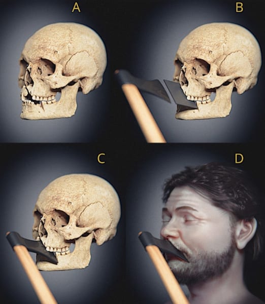 実際の頭蓋骨とそれに斧が刺さった状態、および別アングルからの復元像