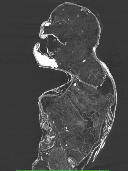 X線CT画像