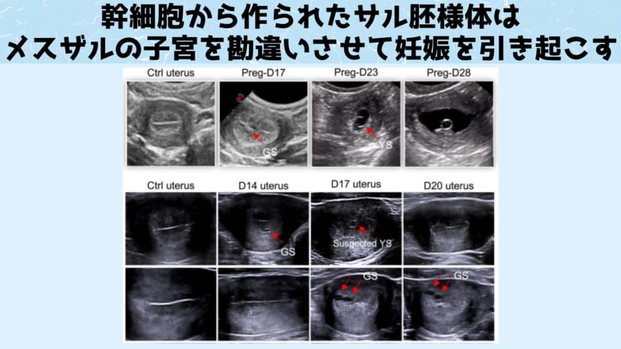 超音波診断により胚様体が子宮を勘違いさせて妊娠を起こしていることがわかる。赤い矢印の部分が妊娠嚢の場所