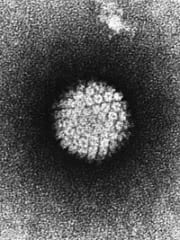 ヒトパピローマウイルスの電子顕微鏡写真