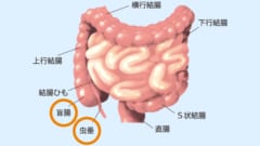 虫垂は盲腸の近くにある小さな袋状の構造