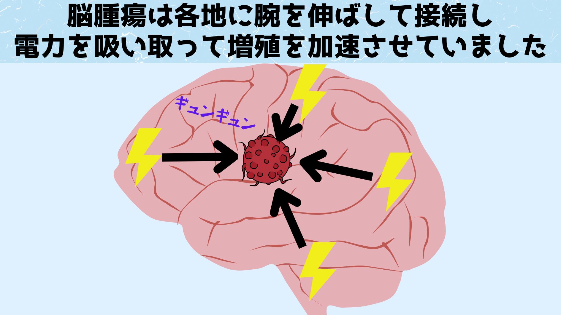 思考自体が脳腫瘍の増殖を促進していると判明！