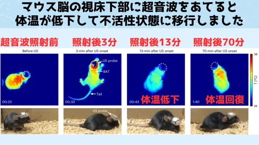 超音波による脳刺激はマウスを「冬眠」のような状態にできると判明！