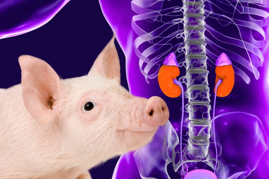 脳死男性に移植した「豚の腎臓」が1カ月以上正常に機能することを確認！