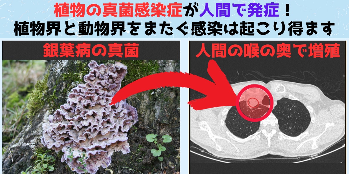 植物の感染症が人間で発症！界をまたぐ真菌感染は起こり得る