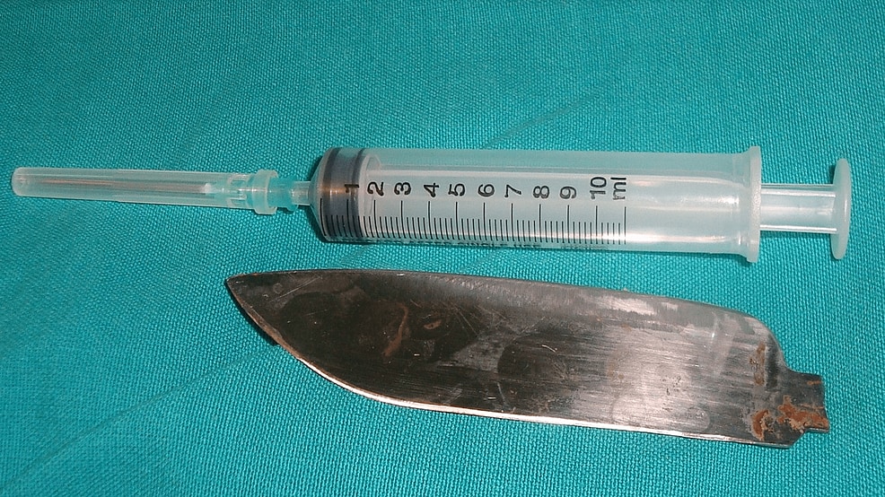 開腹手術で取り出されたナイフの刃