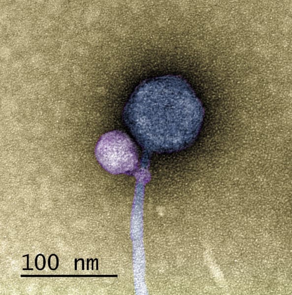 サテライトウイルス（紫）、ヘルパーウイルス（青）
