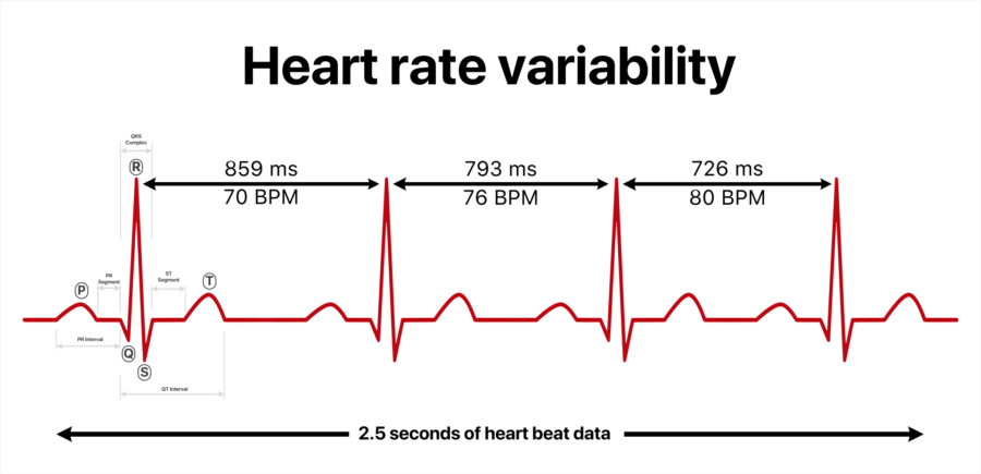 心拍変動のイメージ図（1拍ごとの間隔に変動があると正常な証）