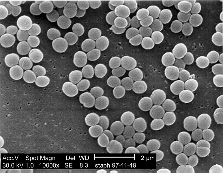 黄色ブドウ球菌の電子顕微鏡写真