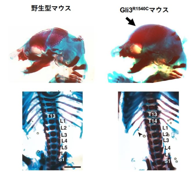 GLI3 R1540Cの導入によるマウス骨格の変化