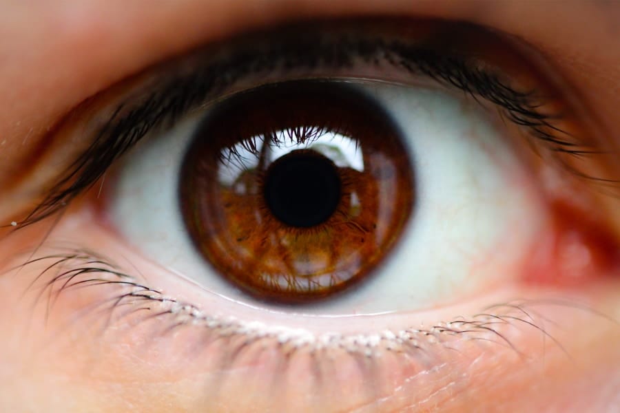 瞳孔:中心の黒い穴。　虹彩:瞳孔の周りの茶色い部分（種によって色や濃さが異なる）