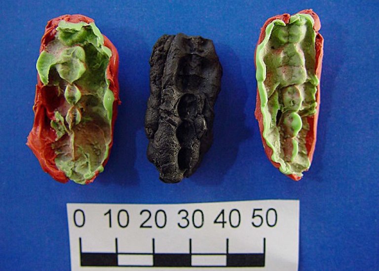 中央がガム遺物、左右の2つは型を取ったもの。左は上顎の歯、右は下顎の歯の痕跡に当たる