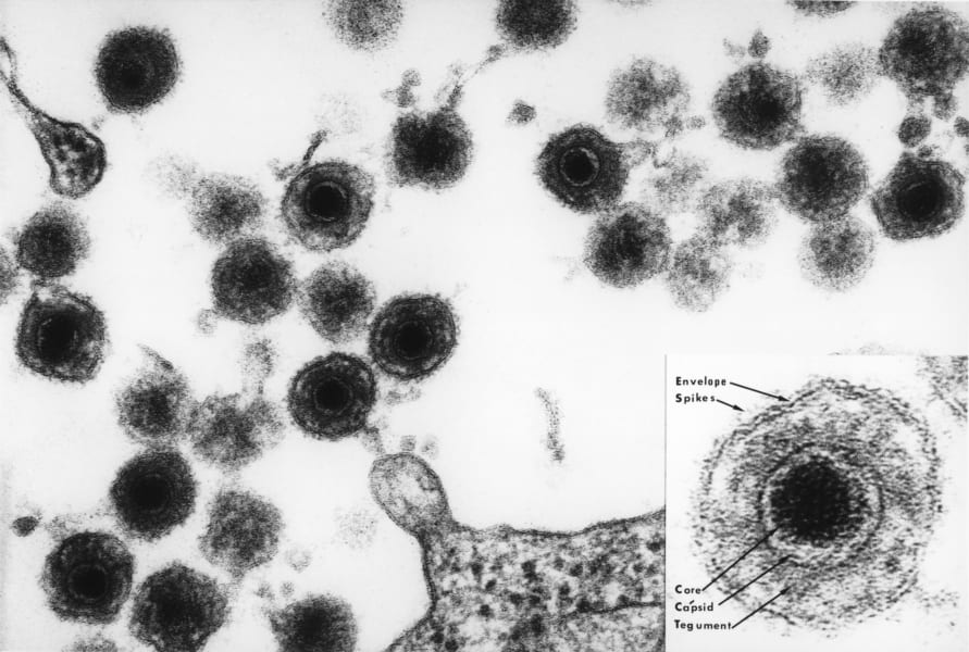 ヒトヘルペスウイルス6(HHV-6)の電子顕微鏡写真