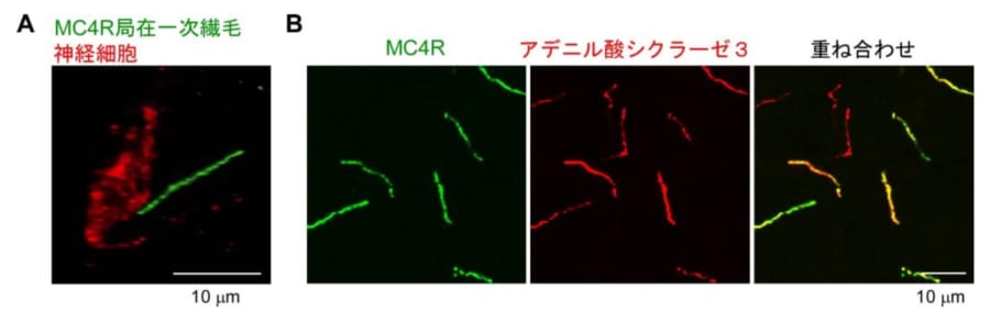 MC4Rは視床下部ニューロンの「一次繊毛」に局在する