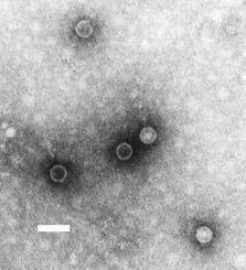 ポリオウイルスの電子顕微鏡画像