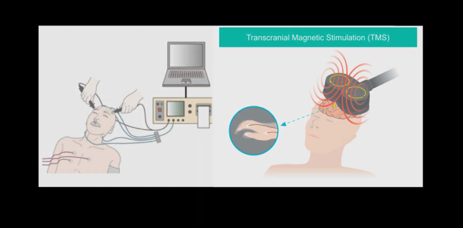 左：電気けいれん療法、右：反復経頭蓋磁気刺激