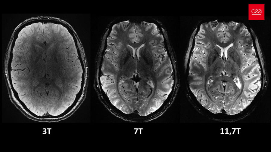 左から3テスラ・7テスラ・11.7テスラのMRIで撮影した脳画像（スキャン時間は4分間で統一）