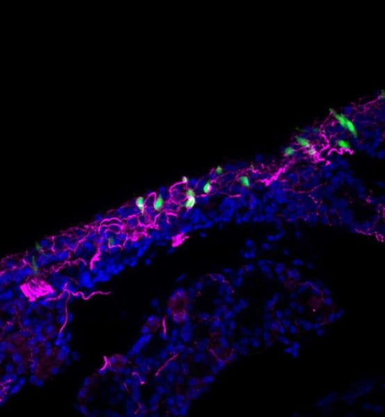 緑：NEC、ピンク：NECの刺激反応で活性化したニューロン