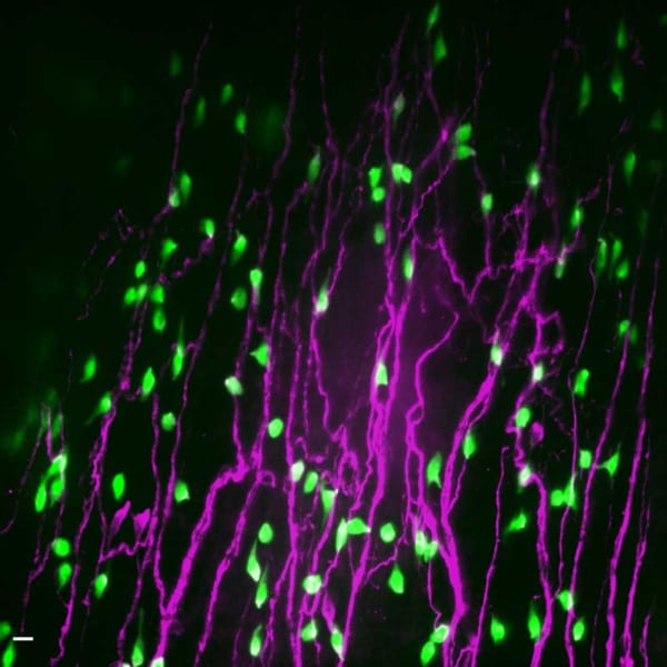 緑：神経内分泌細胞（NEC）、ピンク：NECの反応により活性化したニューロン