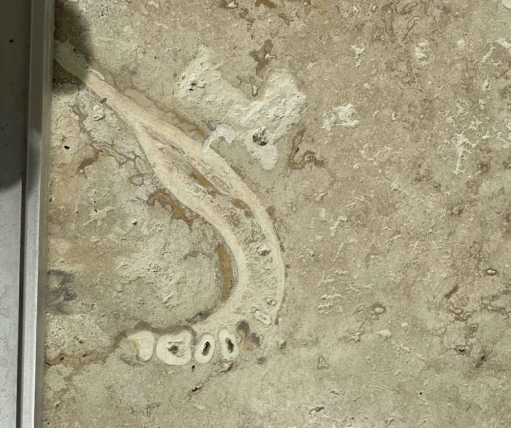 歯科医が床タイルに埋まっている人間の顎骨を発見