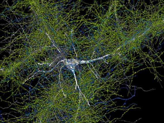 1個のニューロンが5600本の腕（軸索）と結合している様子
