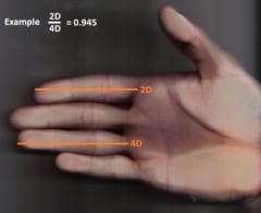 人差し指に比べて薬指が長い場合、2D:4D比は1.0を下回る