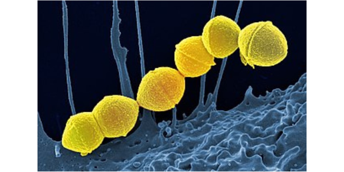 A 群連鎖球菌（化膿連鎖球菌）（黄色）とヒト好中球（青色）のカラー走査型電子顕微鏡写真
