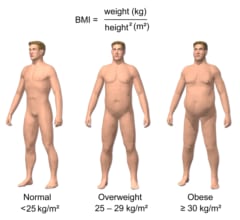 世界的なBMIの基準値（左から普通体重、過体重、肥満）