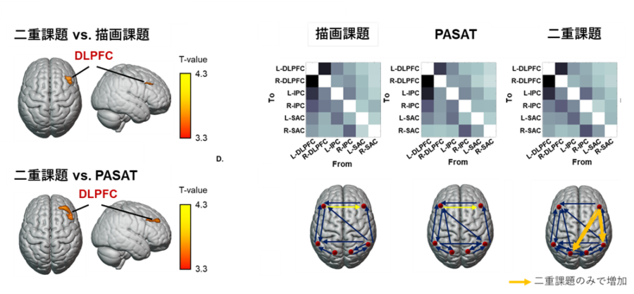 左：マルチタスクで活動が増加した脳領域、右：情報伝達もマルチタスクでのみ増加