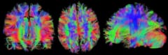 脳内には多くの情報が集まる「ランドマーク的な領域」が存在していたの画像 2/4