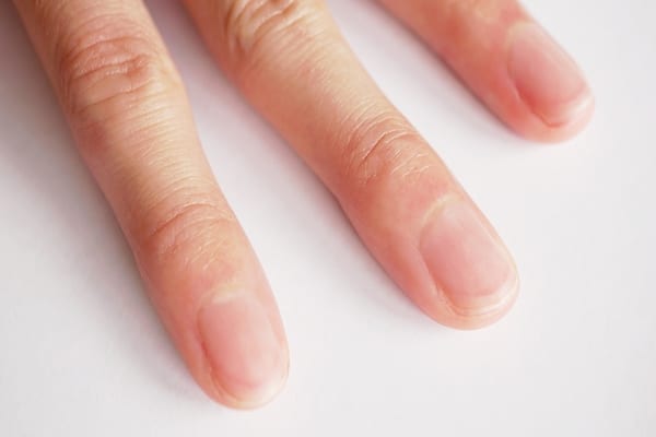 薬指の長い人は持久力が高い？意外なスポーツ科学研究「2D:4D比」