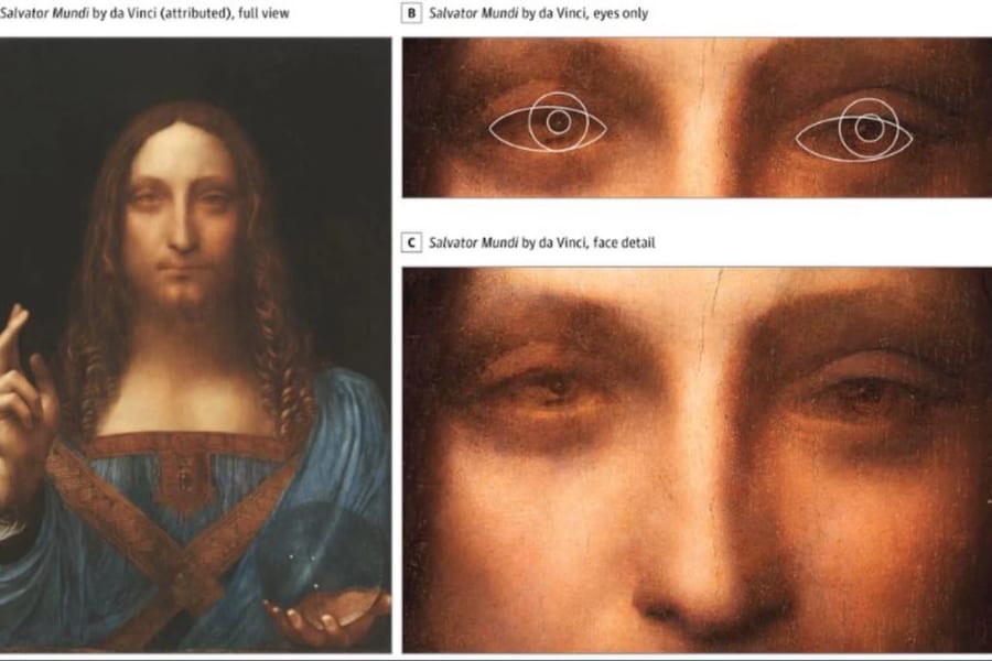 ダ・ヴィンチの天才的な絵の才能は「斜視」が一因だった？